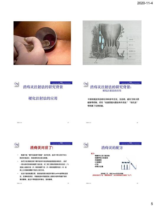 三、六、新型硬化剂消痔灵及临床应用